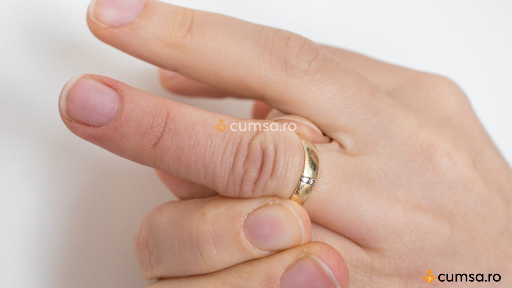 Cum sa scoti un inel de pe degetul umflat