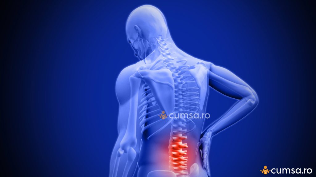 Durerea de spate | Cauze, simptome si tratamentul durerilor de spate | CENTROKINETIC